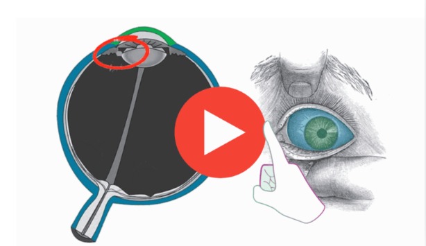 Dr. Ming Wang – Natural Blueberry Method for Cataracts